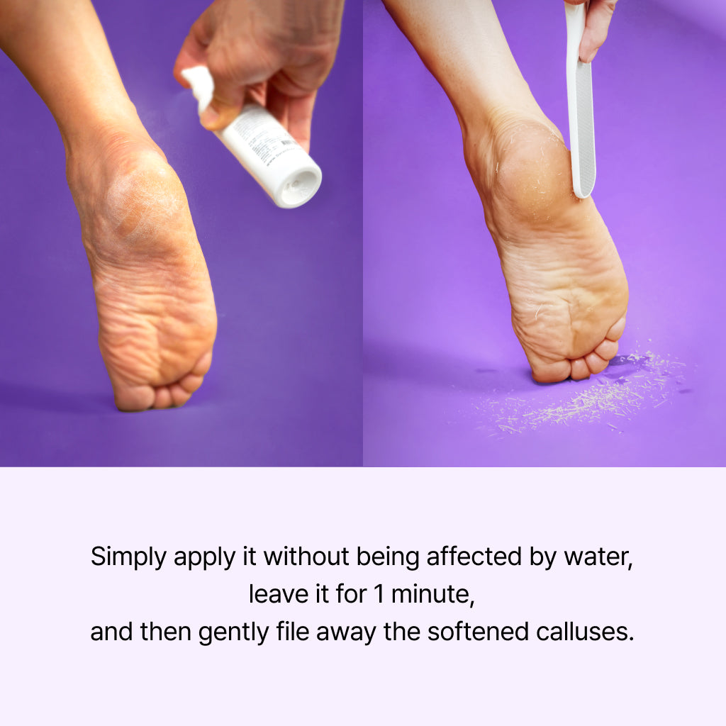 Callus Remover Peeling Foot Spray, 100ml